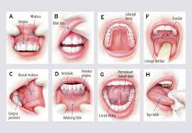 Proses pertama membersihkan mulut ketika kehadiran ulser Ulser Mulut Petanda Awal Kanser