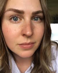 After all, freckles are harmless, simply small spots on your skin which are darker than its surrounding area. A Face Full Of Multi Layered Tattooed Freckles Natural Eh Tattoedfreckles Freckles Freckletattoo Healedfreckl Tattooed Freckles Freckles Freckles Makeup