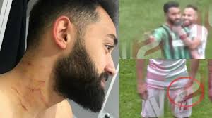 Лига, кубок турции, банк азия 1. Watch Razor Attacks During Amed Sk Vs Sakaryaspor