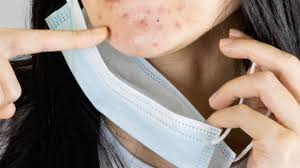 Bien que les ingrédients de ce masque vert soient très efficaces pour réguler le ph de la peau, nous ne devons pas abuser de son application. Covid 19 Tout Savoir Sur L Acne Du Masque