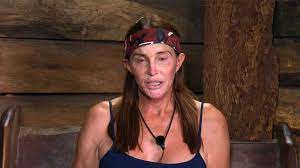 +100 celebrities busted with no makeup. Caitlyn Jenner Plans New Plastic Surgeries