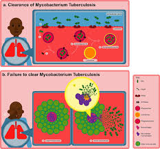 Yuk synonyms, yuk pronunciation, yuk translation, english dictionary definition of yuk. Frontiers The Macrophage Response To Mycobacterium Tuberculosis And Opportunities For Autophagy Inducing Nanomedicines For Tuberculosis Therapy Cellular And Infection Microbiology