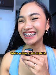 Pipiliin mo ba ang white rubber braces?