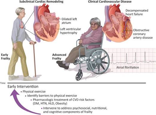 Prevent Frailty, Prevent Cardiovascular Disease: Early Identification of  Patients at Risk | JACC: Advances