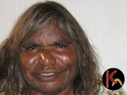 Barbara Reid Napangarti Aboriginal Artist from Kintore, Western Desert  region of Australia; Barbara Reid Napangarti or more commonly known as ...