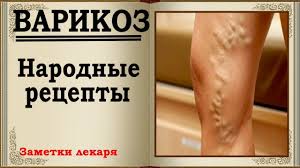 как лечить варикоз на ногах у женщин в домашних условиях Lechenie Varikoza Na Nogah V Domashnih Usloviyah Varikoz Domashnee Lechenie Naturopatiya