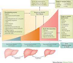 Acute On Chronic Liver Failure In Cirrhosis Nature Reviews Disease Primers