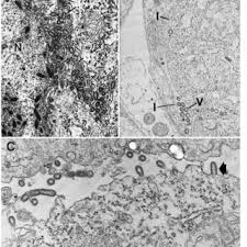 Image result for Isonema