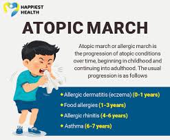 Image result for Allergic Triad