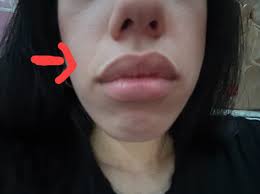 If you have these lines