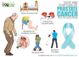 What causes germ cells to become abnormal and. Beat Prostate Cancer Medcare Spainmedcare Spain