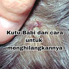 Bau yang menyengat dari kotoran babi ini seolah akan nah, demikianlah artikel dari kami tentang cara mengatasi hama babi pada tanaman sawit. Kutu Babi Dan Cara Untuk Menghilangkannya Kisahsidairy Com