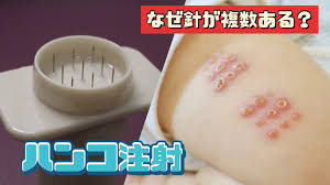 ハンコ 注射 跡