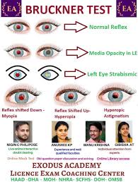 Image result for Red Reflex