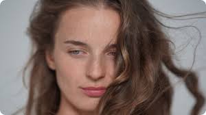 Photofacial treatments during summer