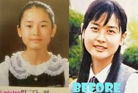 Nữ hoàng dao kéo' Lee Da Hae lộ diện với gương mặt khác lạ, dấy lên nghi  vấn nghiện 'dao kéo' đến mức biến chứng