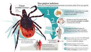 Les manifestations du stade tertiaire de la borréliose de lyme peuvent apparaître plus d'un an, voire de nombreuses années après la morsure de tique. Comment Se Proteger De La Maladie De Lyme
