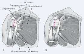 Muscles allow us to move by pulling on bones. Figure 2 From Open Reconstruction Of The Anterior Glenohumeral Capsulolabral Structures With Tendon Allograft In Chronic Shoulder Instability Semantic Scholar