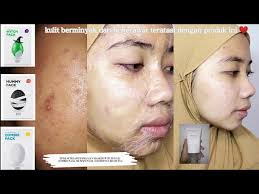 Review jujur masker witch pack, zombie pack, dan mummy pack+soothing cream  by skin 1004