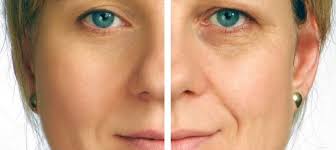 Anti-Aging Supplements