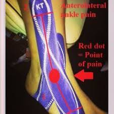 Pin On Taping