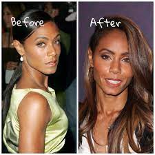 Pinkett smith herself has never admitted to having plastic surgery. Jada Pinkett Smith Plastic Surgery Herinterest Com Jada Pinkett Smith Plastic Surgery Celebrity Plastic Surgery