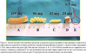 Questa classificazione viene chiamata abc della dieta dei celiaci. Quanto Glutine In Una Briciola Di Pane