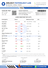Image result for Liver Function Test Abnormality