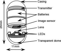 Image result for Wireless Capsule Endoscopy