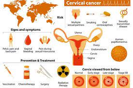 It may include some form of surgical intervention, chemotherapy, radiotherapy, or a combination of these treatments. Cervical Cancer Causes Symptoms Treatment Gleneagles Hospital