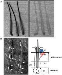 When i look at these hairs, they never have white bulbs attached to them. Hair Bulbs And Mid Segments Of Hair Follicles Were Micro Dissected From Download Scientific Diagram
