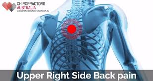 Small part of rv 3. Pin On Chiropractors Australia