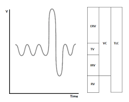 Image result for Lung Function Questionnaire