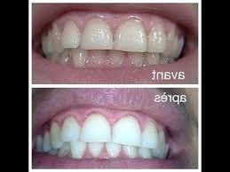 Charbon dent blanche 60 g. Blanchir Les Dents Avec Du Charbon Vegetal Ou Blanchiment Dent Formation Comment Les Bons Choix La Reference 2020