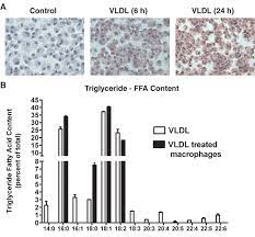 The Role Of Lipolysis In Mediating The Proinflammatory Effects Of Very Low Density Lipoproteins In Mouse Peritoneal Macrophages Journal Of Lipid Research