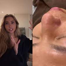 Lily Philips 101 Men | TikTok