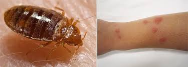 Image result for bedbugs bites