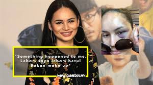 Insiden dikecam netizen kerana berpakaian seksi bersama pelakon yang juga teman baiknya, kilafairy, beberapa bulan lalu, memberi kesan emosi terhadap bintang jelita, izara aishah. Gigi Patah Dan Mata Lebam Apa Dah Jadi Dengan Izara Aishah Oh Media