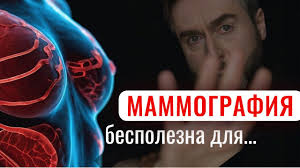 Не делайте маммографию, пока не посмотрите это видео