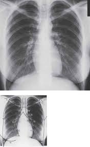 51 years experience in nuclear medicine angled view. Examination Technique And Normal Findings Radiology Key