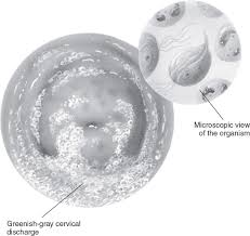 Image result for Friable Cervix