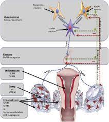 How can endometriosis be diagnosed? New Developments In The Medical Treatment Of Endometriosis Fertility And Sterility