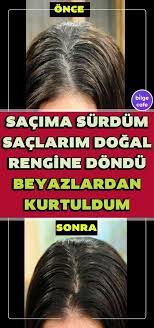 Sacinizin Dogal Rengine Donuyor Beyazlardan Kurtuluyorsunuz Sac Dogal Sac Bakimi Saglik