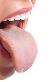 Image result for cancer of tongue