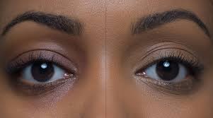 Cara menghilangkan kerutan pada bawah mata dengan bubuk cendana sebenarnya bukanlah cara baru. Penyebab Dan Cara Mengatasi Berbagai Tipe Lingkaran Hitam Di Bawah Mata Beauty Journal