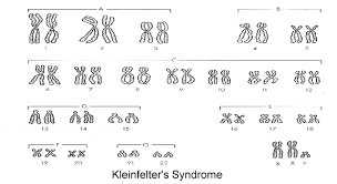 human genetics