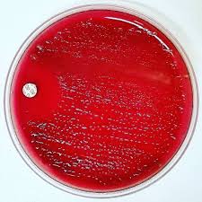 Pin On Microbiology By Antisocial Met