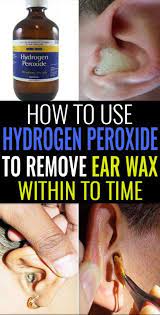 How To Use Hydrogen Peroxide To Remove Ear Wax Ear Cleaning Wax Peroxide For Ear Infection Clean Ear Wax Out