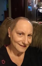 Chemotherapy and Hair Regrowth