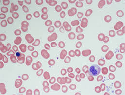 Memory cell and plasma cells are the two types of b cells. What The Blood Tests Of A Covid 19 Patient Can Tell Us